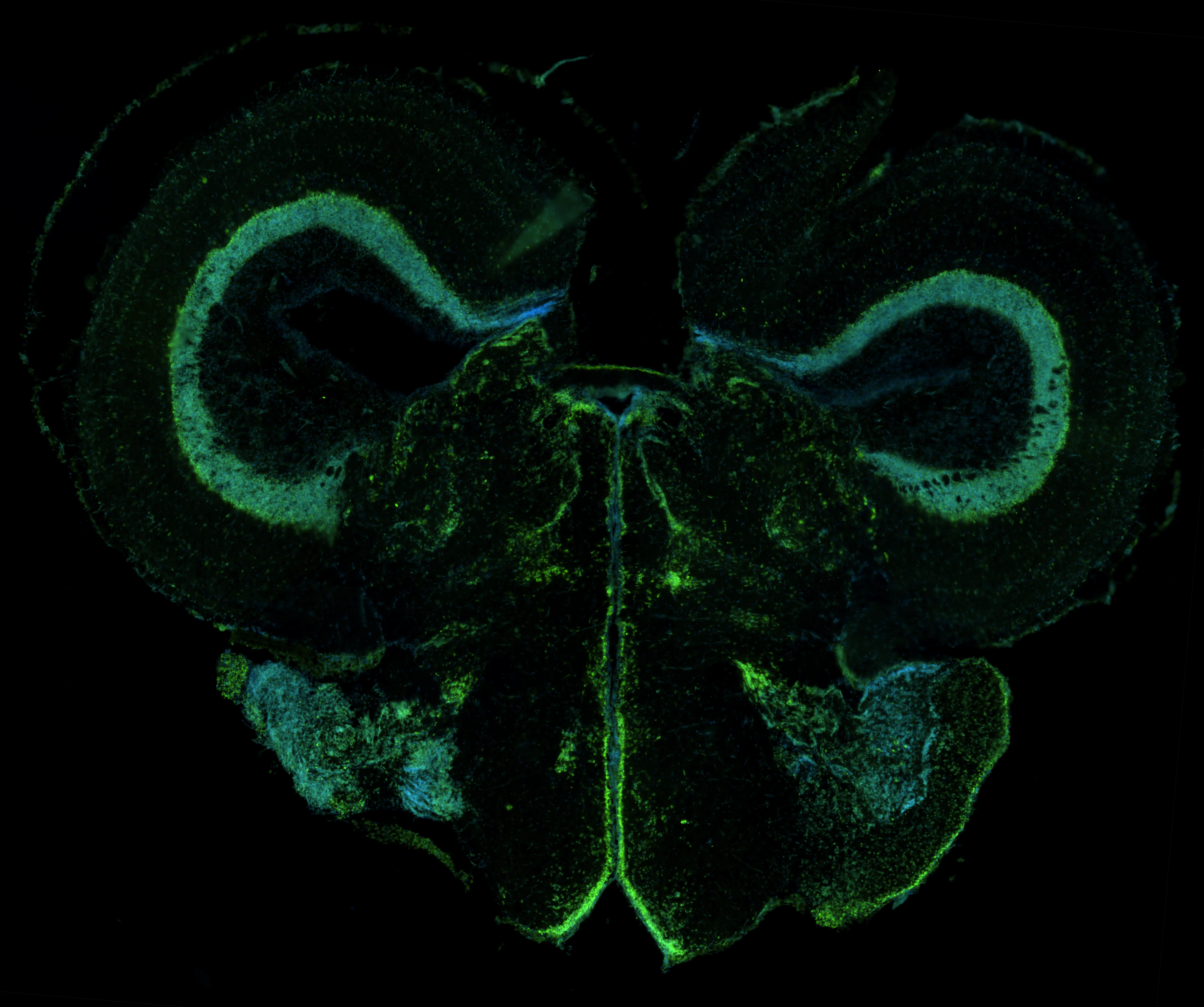 Neuroimaging of a brain